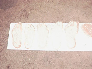 shows plaster casts of feet