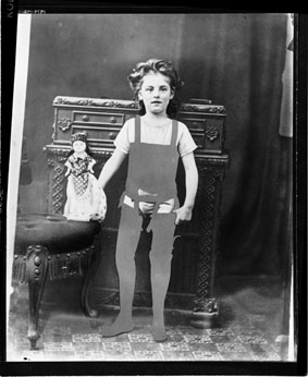 Edwardian photo of prosthetic user with prosthesis removed from the picture