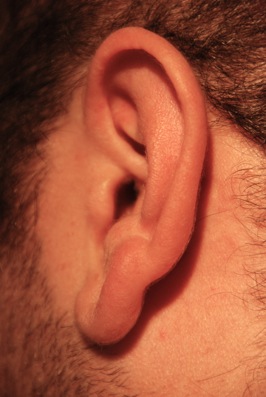 Colour photograph of a young man's ear, surrounded by short dark thick curly hair.