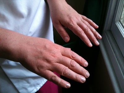 Colour photograph of a woman's hands being held out against a clinical white jacket in the light from a nearby window.