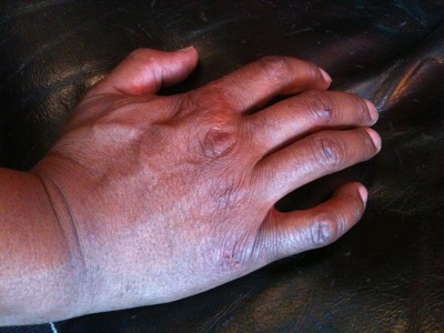 Colour photograph of a Black man's hand resting against a darker leather background.